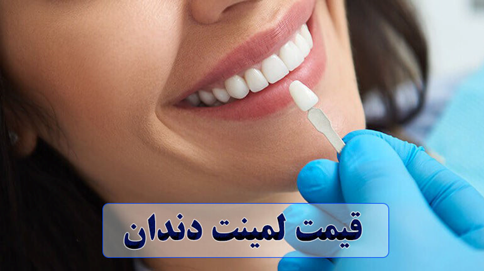 قیمت لمینت دندان 1404