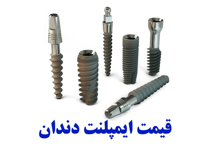 قیمت ایمپلنت دندان