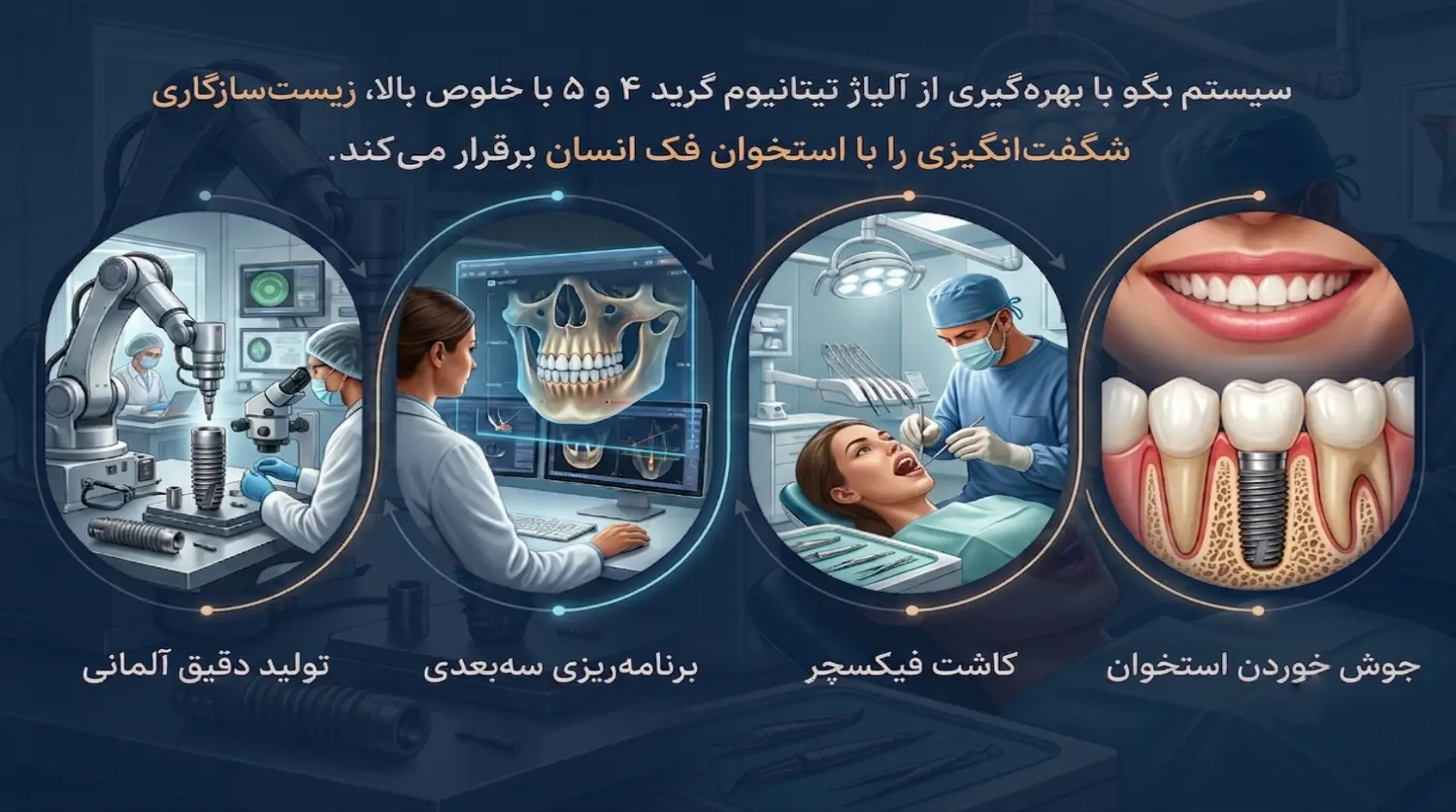 implant bego.2